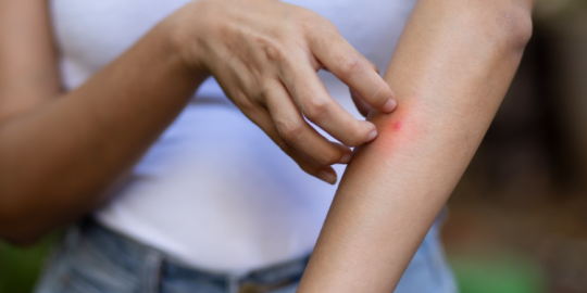 Actualit&eacute; de la semaine : La dengue et la leptospirose continuent d'inqui&eacute;ter