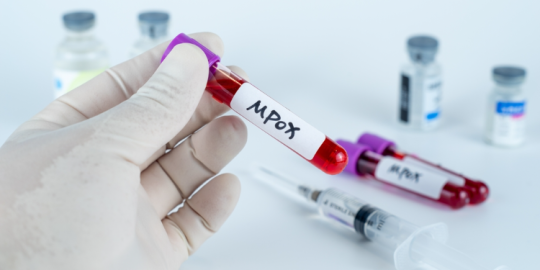 Actu de la semaine : premier cas import&eacute; de Mpox identifi&eacute; &agrave; Maurice