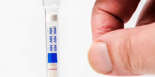 Actualit&eacute;s de la semaine : Autotest de d&eacute;pistage du VIH maintenant l&eacute;gal